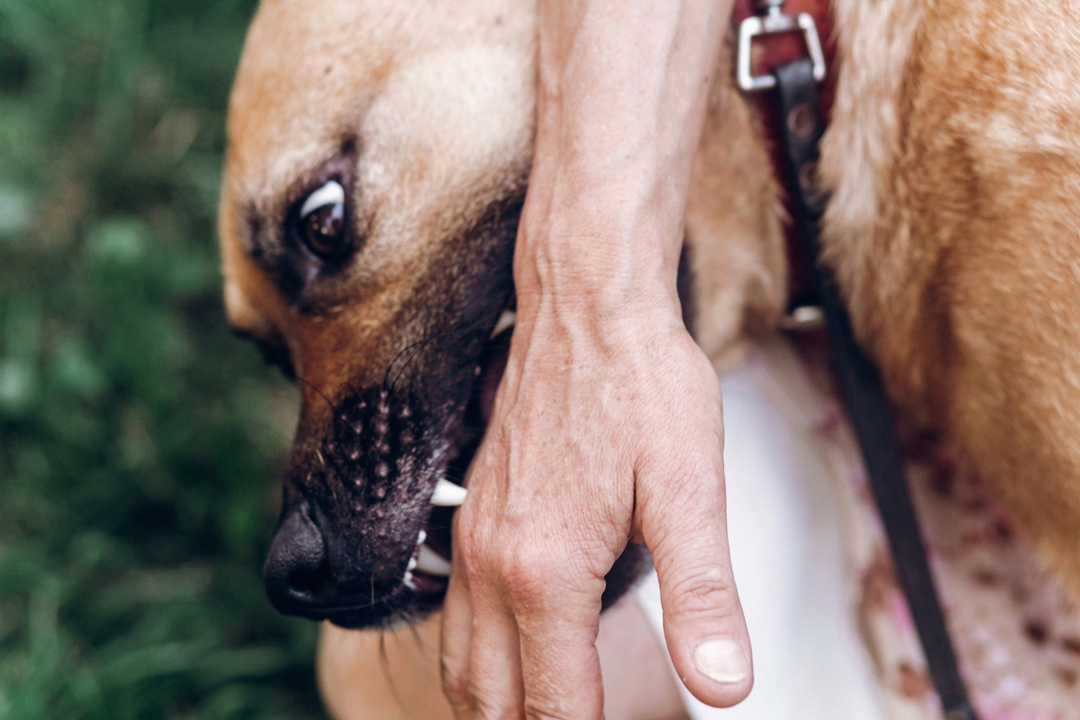 Close-up of a tan dog on a leash biting a person's wrist, teeth bared, against a blurred green outdoor background.